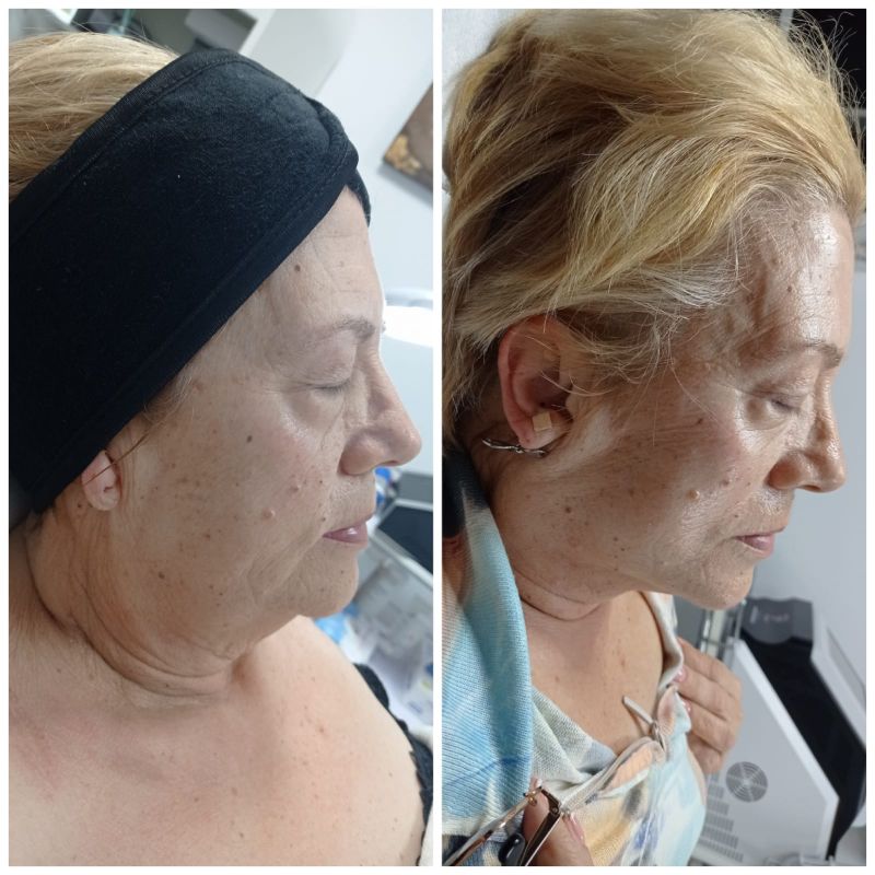 facial personalizado (1)