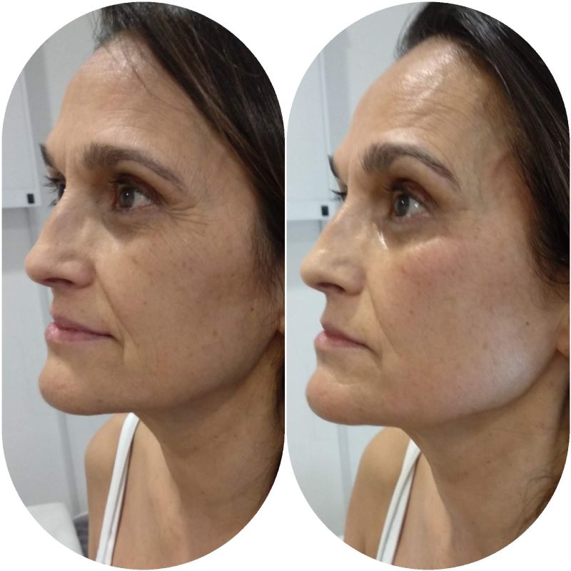 Facial personalizado (2)
