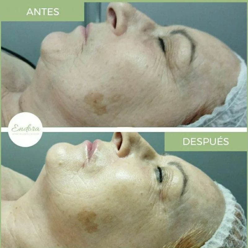 Facial personalizado (3)