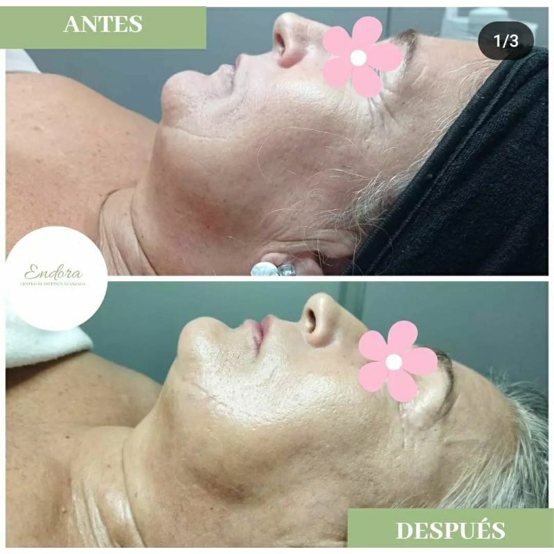 Facial personalizado (5)
