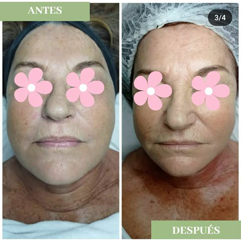 Facial personalizado